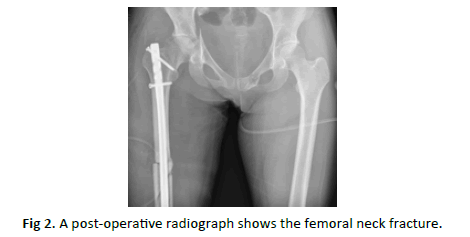 Orthopaedics-Trauma-Surgery-post-operative-radiograph
