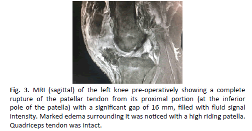 Orthopaedics-Trauma-Surgery-quadriceps