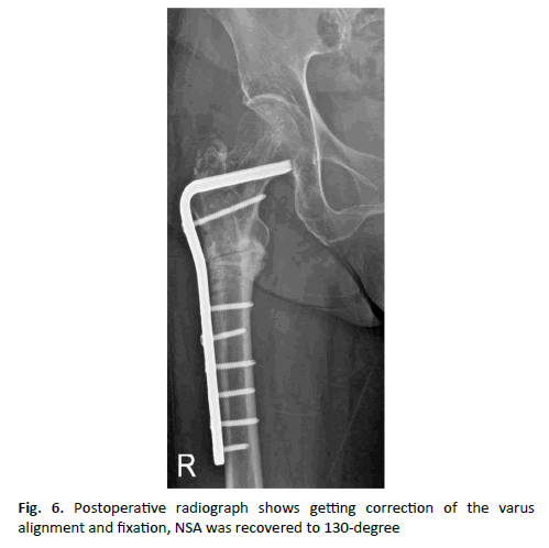 Orthopaedics-Trauma-Surgery-radiograph