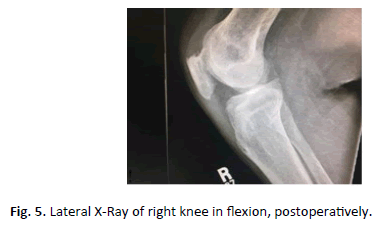 Orthopaedics-Trauma-Surgery-right-knee