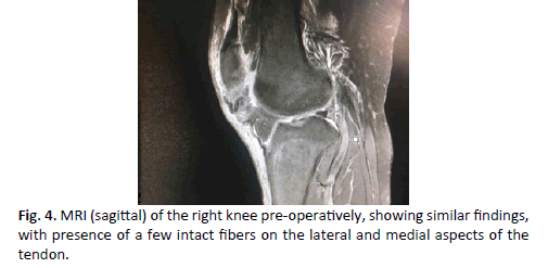 Orthopaedics-Trauma-Surgery-sagittal