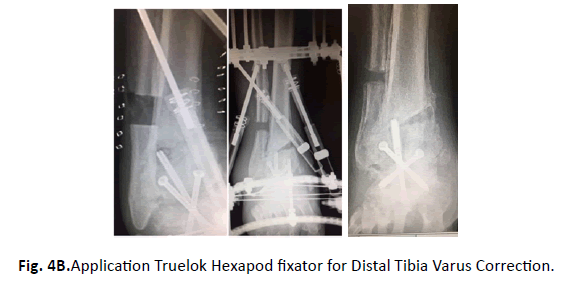 Orthopaedics-Trauma-Surgery-truelok